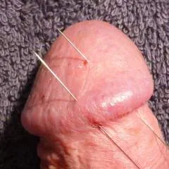 Blueballs photo on Jungo Live