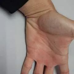 Apisz photo on Jungo Live