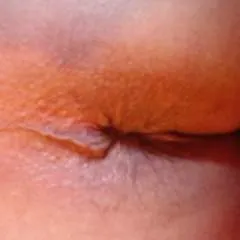 Circumize photo on Jungo Live