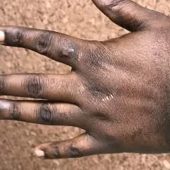 Yoo photo on Jungo Live