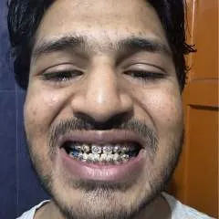 Samprt photo on Jungo Live