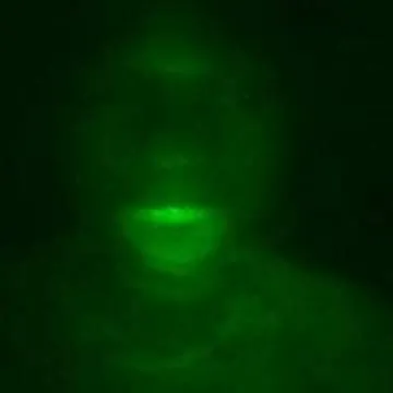 Nasco Photo On Jungo Live