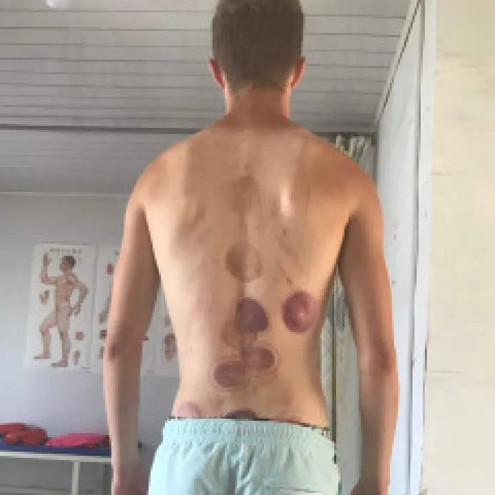 Coren Photo On Jungo Live