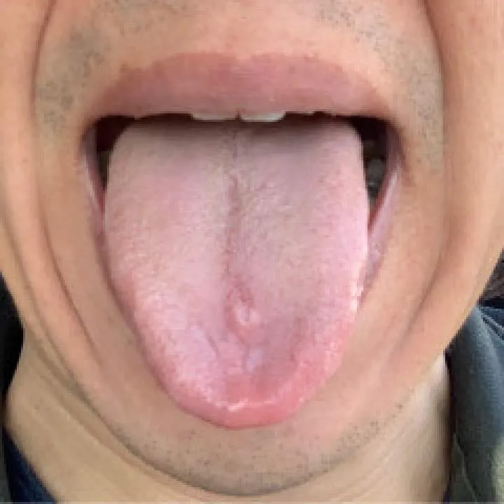 Guest Photo On Jungo Live