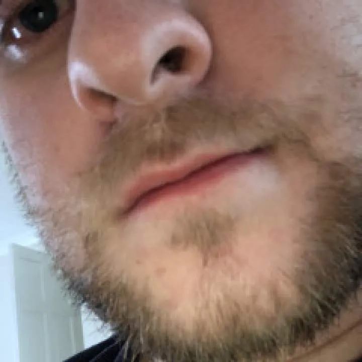 Cagedharry Photo On Jungo Live