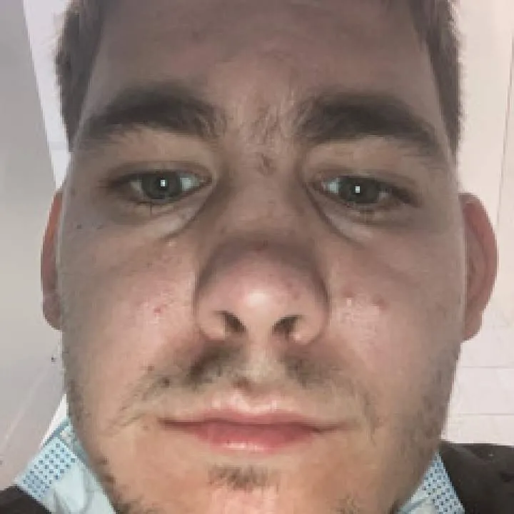 Skip Photo On Jungo Live