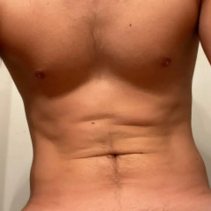 Loganberry Photo On Jungo Live