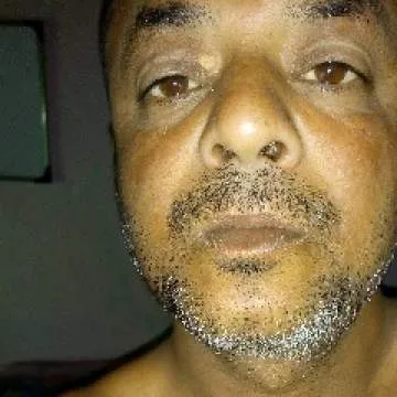 Hungry Photo On Jungo Live