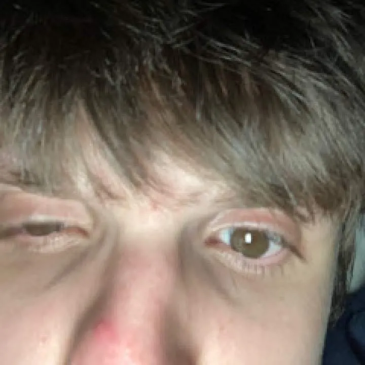 Fire Photo On Jungo Live