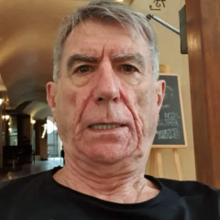 P.m.s Photo On Jungo Live