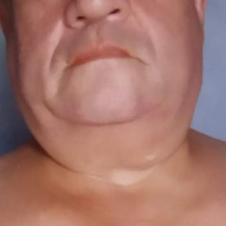 Jair López Photo On Jungo Live