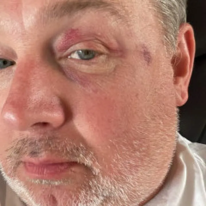 Richie Photo On Jungo Live