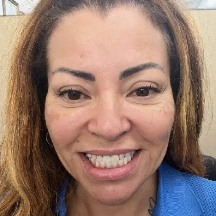 Leeleesbabyarm Photo On Jungo Live