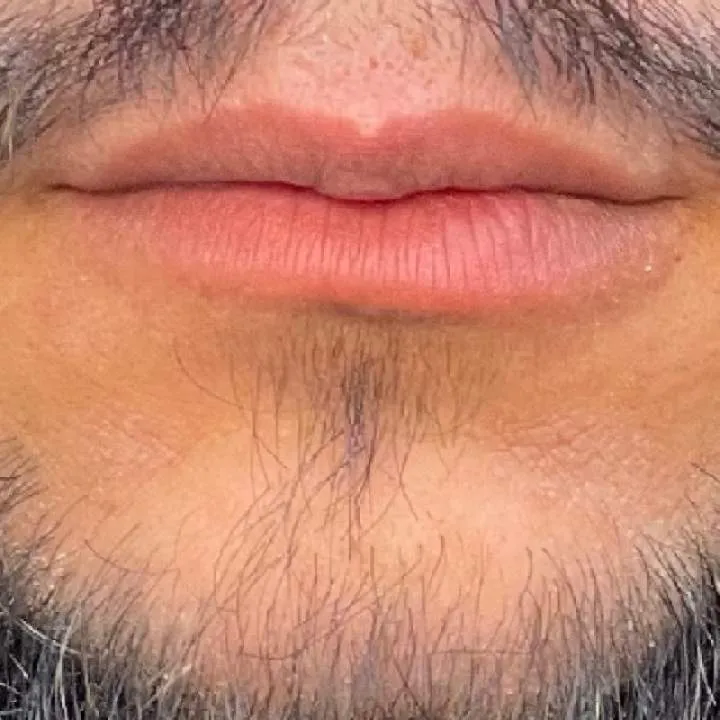 Sparkyhiv35( Photo On Jungo Live