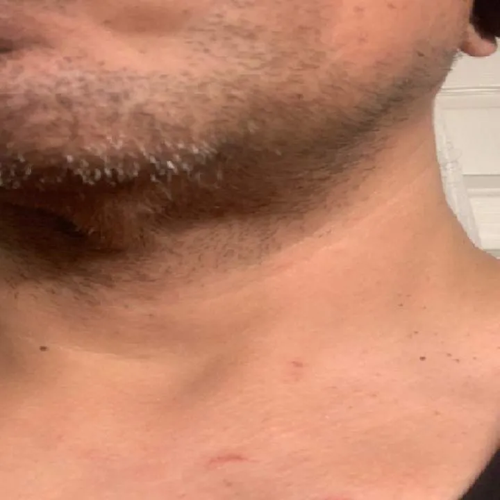 Dckfryouifuwant2sucknfck Photo On Jungo Live