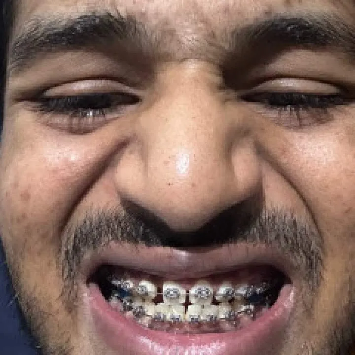 Samprt Photo On Jungo Live